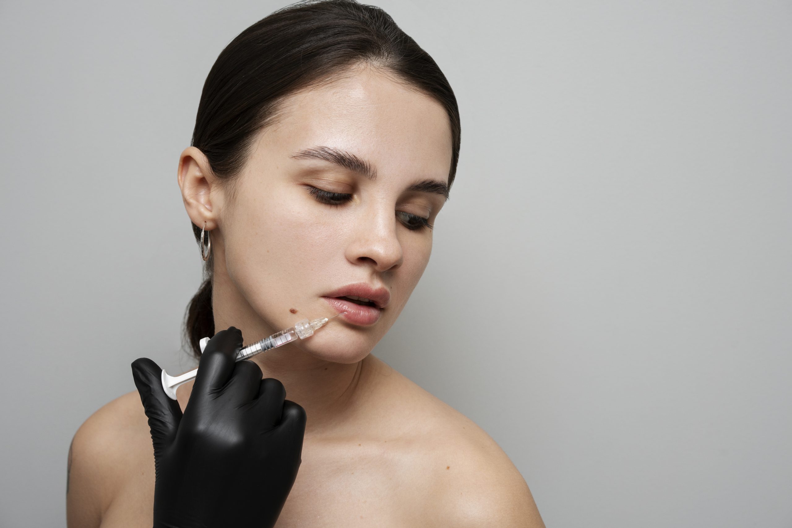 Filler behandeling bij Perfect Look Klinieken